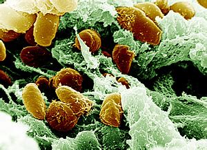  Yersinia pestis! A Tiny Terror with Enormous Evolutionary Prowess