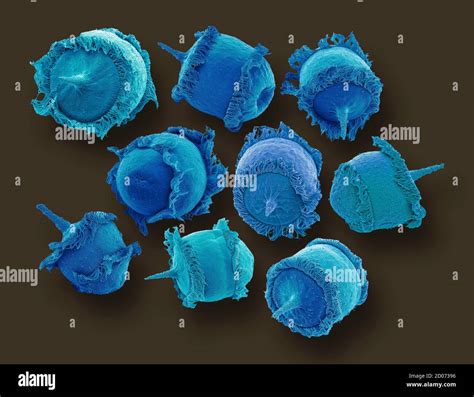 Didinium –  Ten Tiny Ciliate That Engulf its Prey Like a Microscopic Pac-Man!