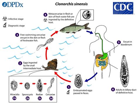  Klonorchis Sinensis: The Fluke That Loves Bile (and Makes Your Liver Itch)!